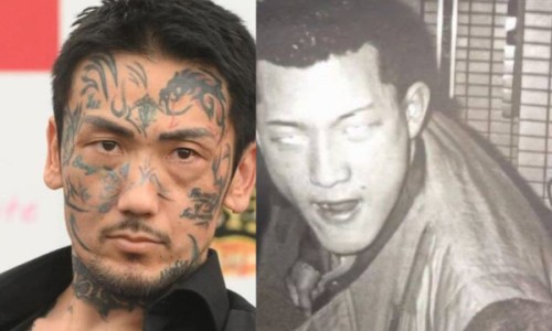 肠胃不好身上好大的腥味怎么办、肠胃不好刺鼻味道 -肠胃不好身上好大的腥味网